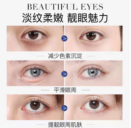 【台灣現貨】賣2發3  熱熔霜ana肌先知眼霜 淡化細紋 祛斑美白 熬夜淡化黑眼圈眼袋緊緻抗皺細紋去皺紋眼袋