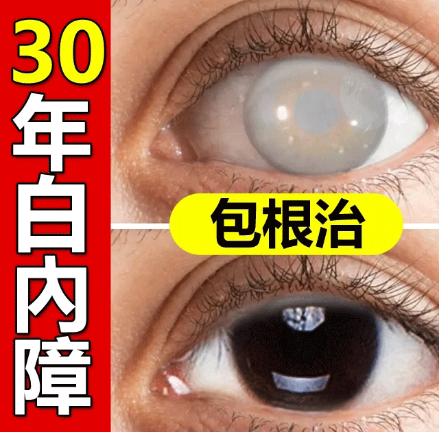 【日本最新白內障滴眼液】治療:近視/遠視/散光/老花眼/乾眼/青光眼/白內障/眼疲勞/角膜炎症/黃斑變性/翼狀胬肉等眼部疾病 無需手術,治療你的眼疾。健康的眼睛,讓世界更明亮 【日本最新白內障滴眼液】治療:近視/遠視/散光/老花眼/乾眼/青光眼/白內障/眼疲勞/角膜炎症/黃斑變性/翼狀胬肉等眼部疾病 無需手術,治療你的眼疾。健康的眼睛,讓世界更明亮