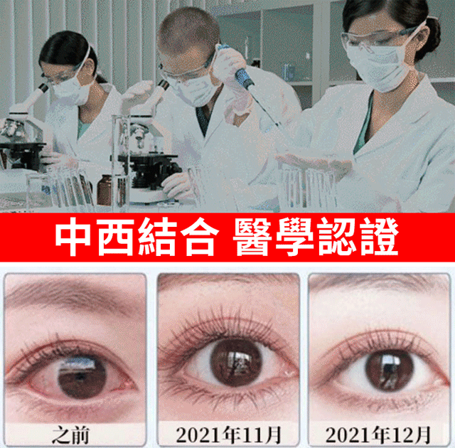 【日本最新白內障滴眼液】治療:近視/遠視/散光/老花眼/乾眼/青光眼/白內障/眼疲勞/角膜炎症/黃斑變性/翼狀胬肉等眼部疾病 無需手術,治療你的眼疾。健康的眼睛,讓世界更明亮 【日本最新白內障滴眼液】治療:近視/遠視/散光/老花眼/乾眼/青光眼/白內障/眼疲勞/角膜炎症/黃斑變性/翼狀胬肉等眼部疾病 無需手術,治療你的眼疾。健康的眼睛,讓世界更明亮