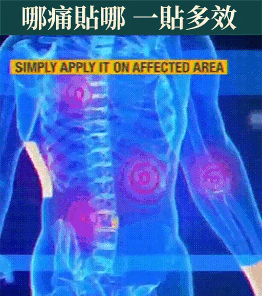火爆熱銷中!坐骨神經腰間盤關節頸肩腰腿半月貼！1盒10貼,無任何副作用!